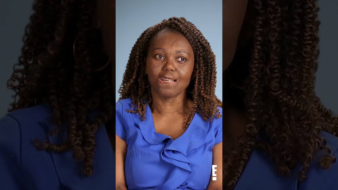 Jannie's lip disintegrated in a horrible childhood accident #botched