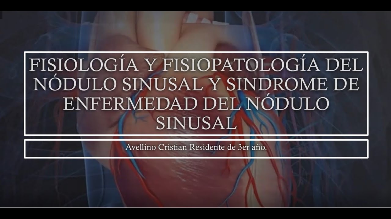 ENFERMEDAD DEL NODO SINUSAL