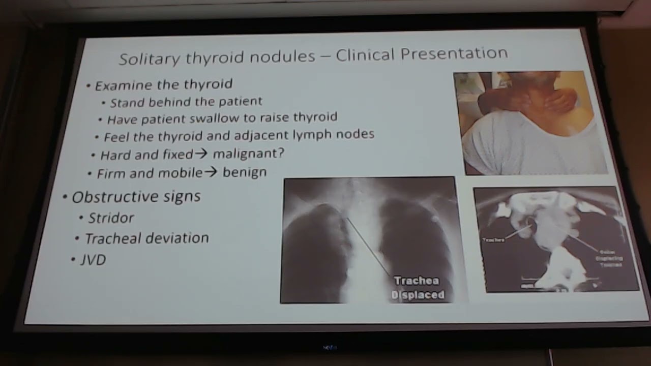 Surgery Block 2 Lecture 6