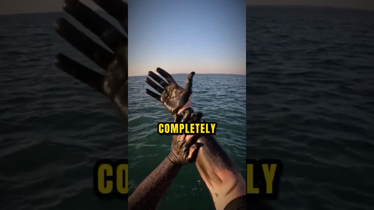 Squid Ink Left Permanent Marks on His Skin...