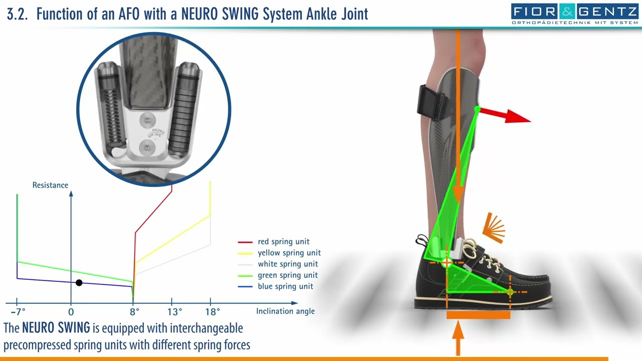 EN: The Right Orthosis in case of a Combined Weakness of the Dorsiflexors and Plantar Flexors (3/4)
