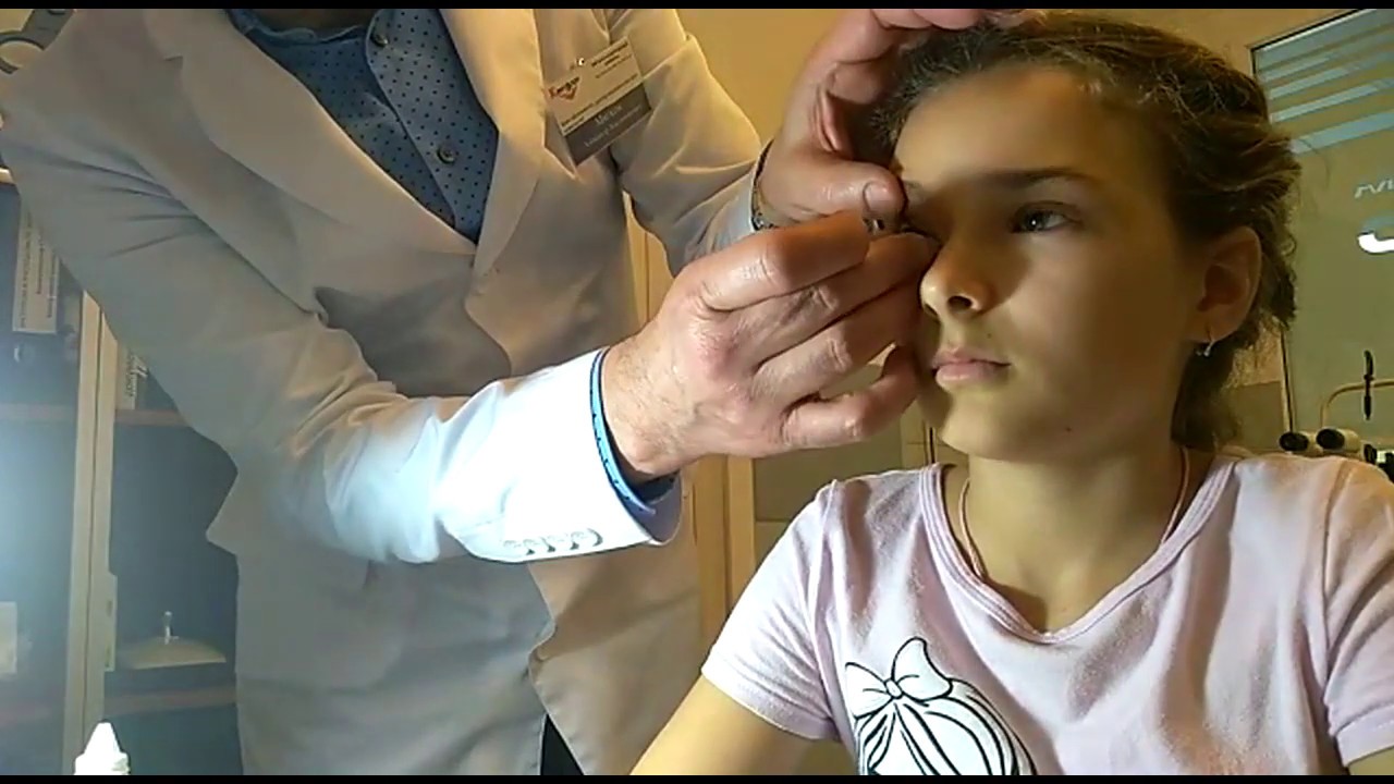 Надевание мягкой бифокальной линзы OKVision Prima BIO-Bi-focal