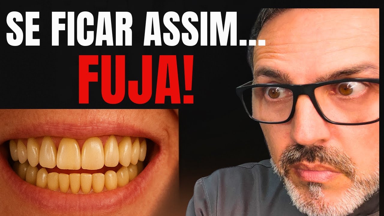 FUJA se Seus Dentes dos Implantes  Começarem a Ficar Desse Tamanho