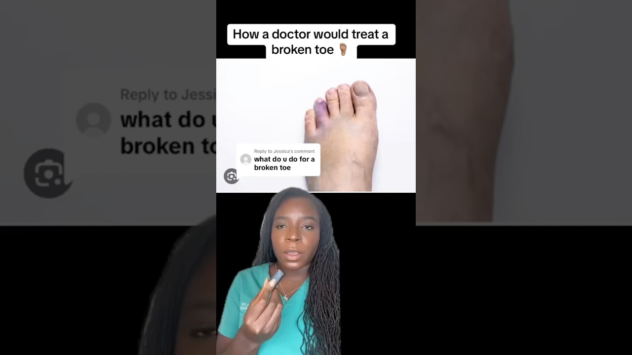 What a Foot Doctor Would Do For a Broken Toe #footdoc #podiatry #foothealth