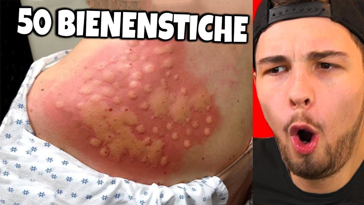 Menschen die einen SCHLECHTEREN TAG hatten ALS DU