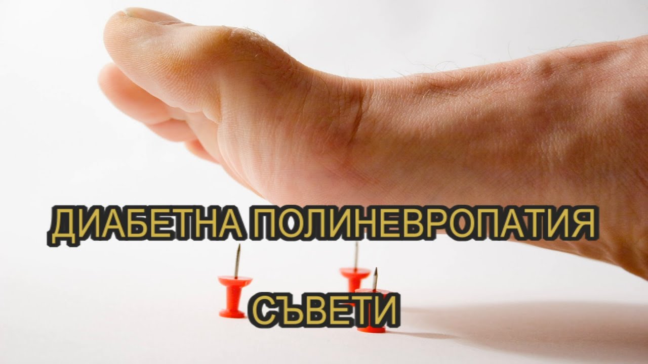 Диабетна полиневропатия – как да я овладеем