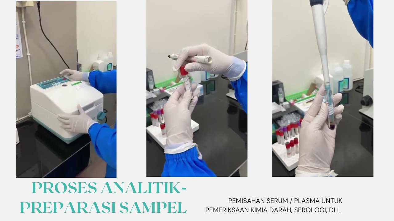 PELAYANAN LABORATORIUM- RSUD SURADADI KAB TEGAL