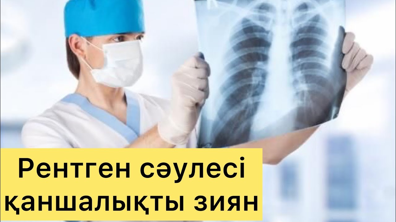 РЕНТГЕН СӘУЛЕСІ ҚАНШАЛЫҚТЫ ЗИЯН. Рентгенге жылына қанша рет түсу керек?!