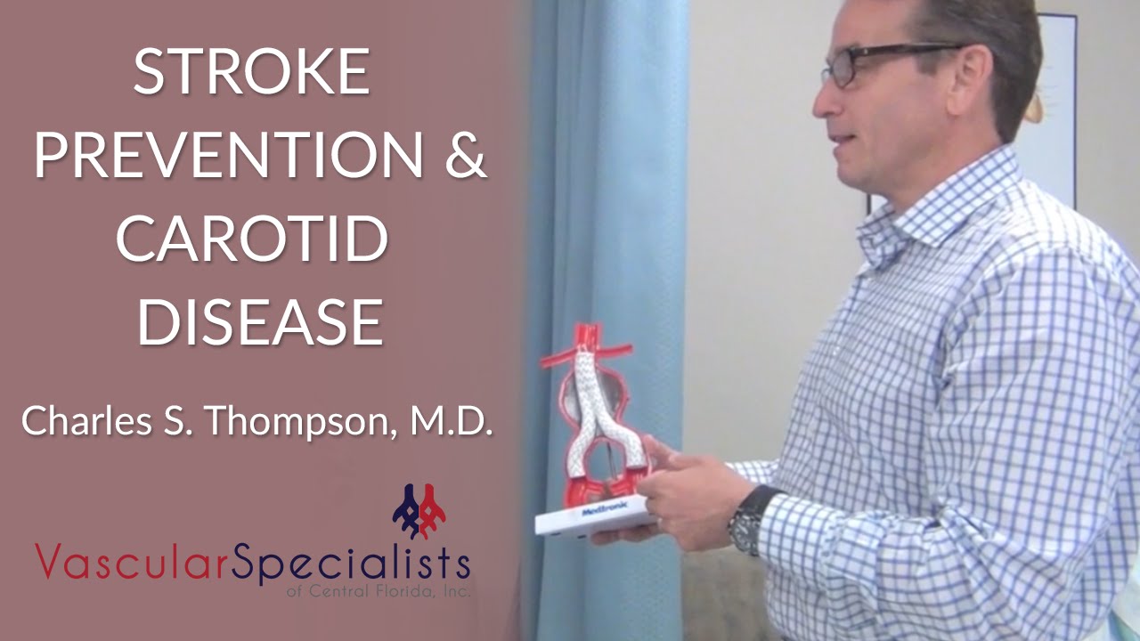 Stroke Prevention and Carotid Disease