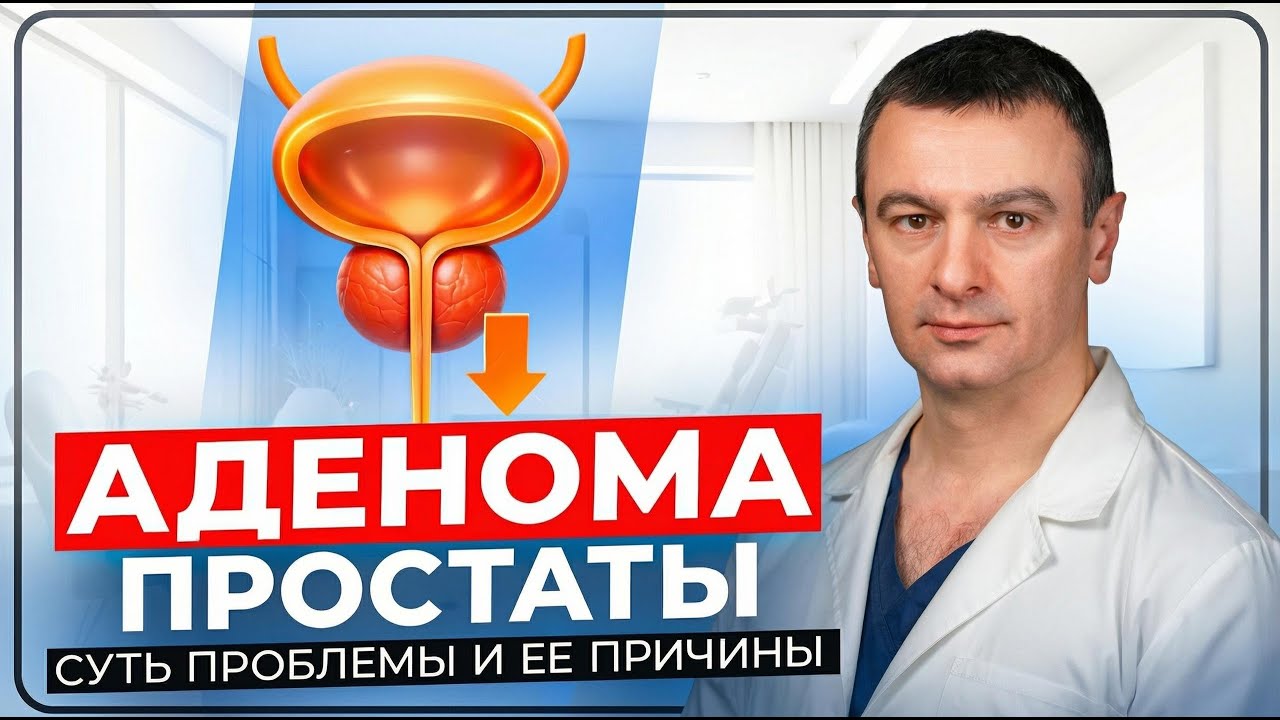 Аденома простаты. Почему появляется и что собой представляет?