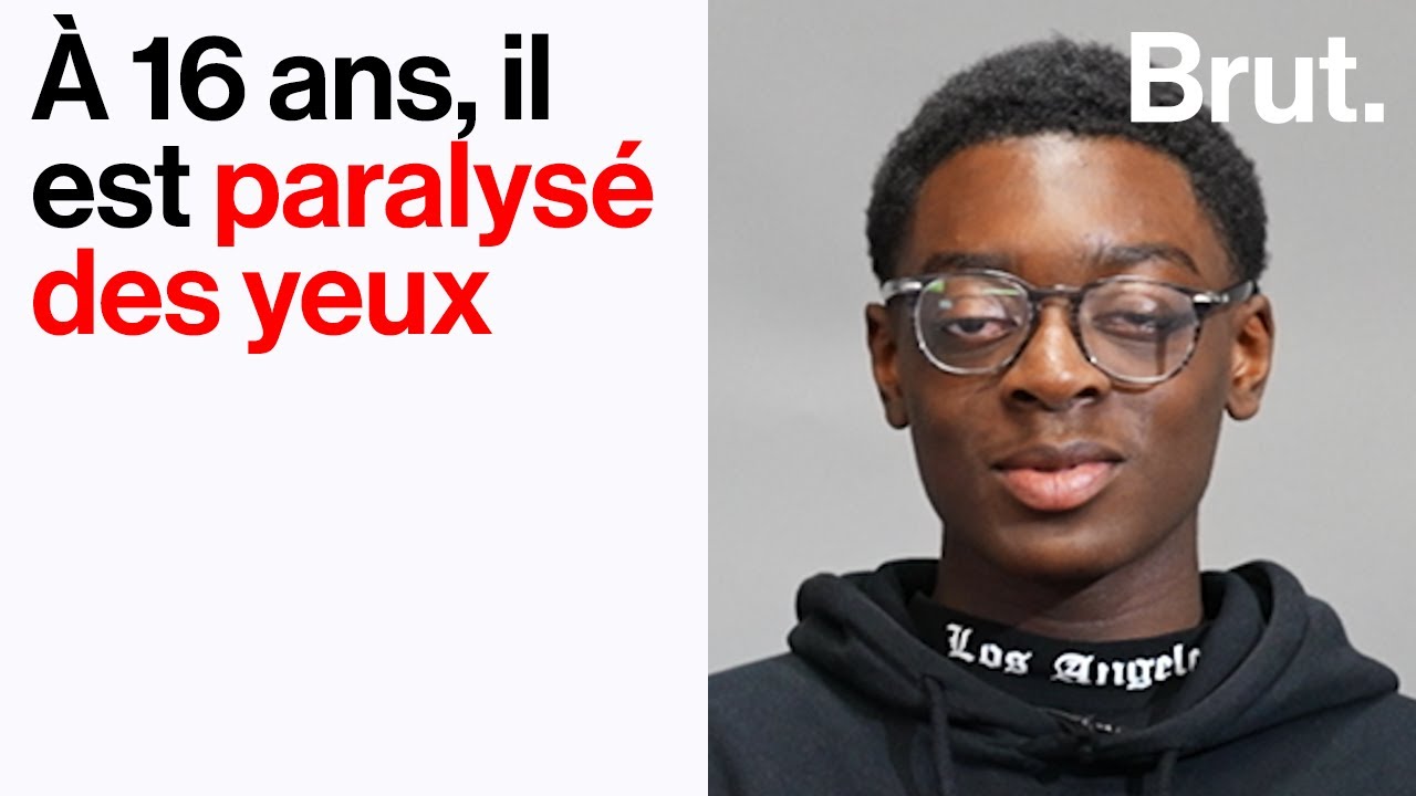 Il est paralysé des yeux