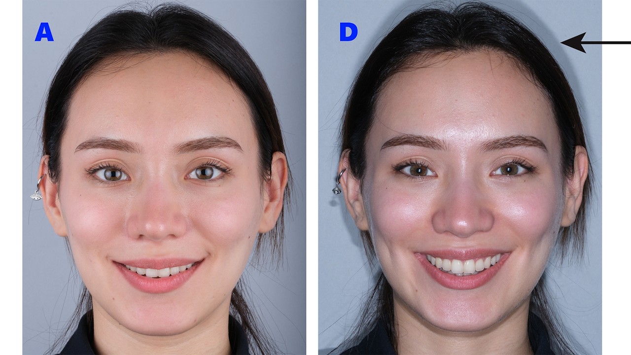 Dental Fotoğrafçılık - 5: Işık kıyaslama