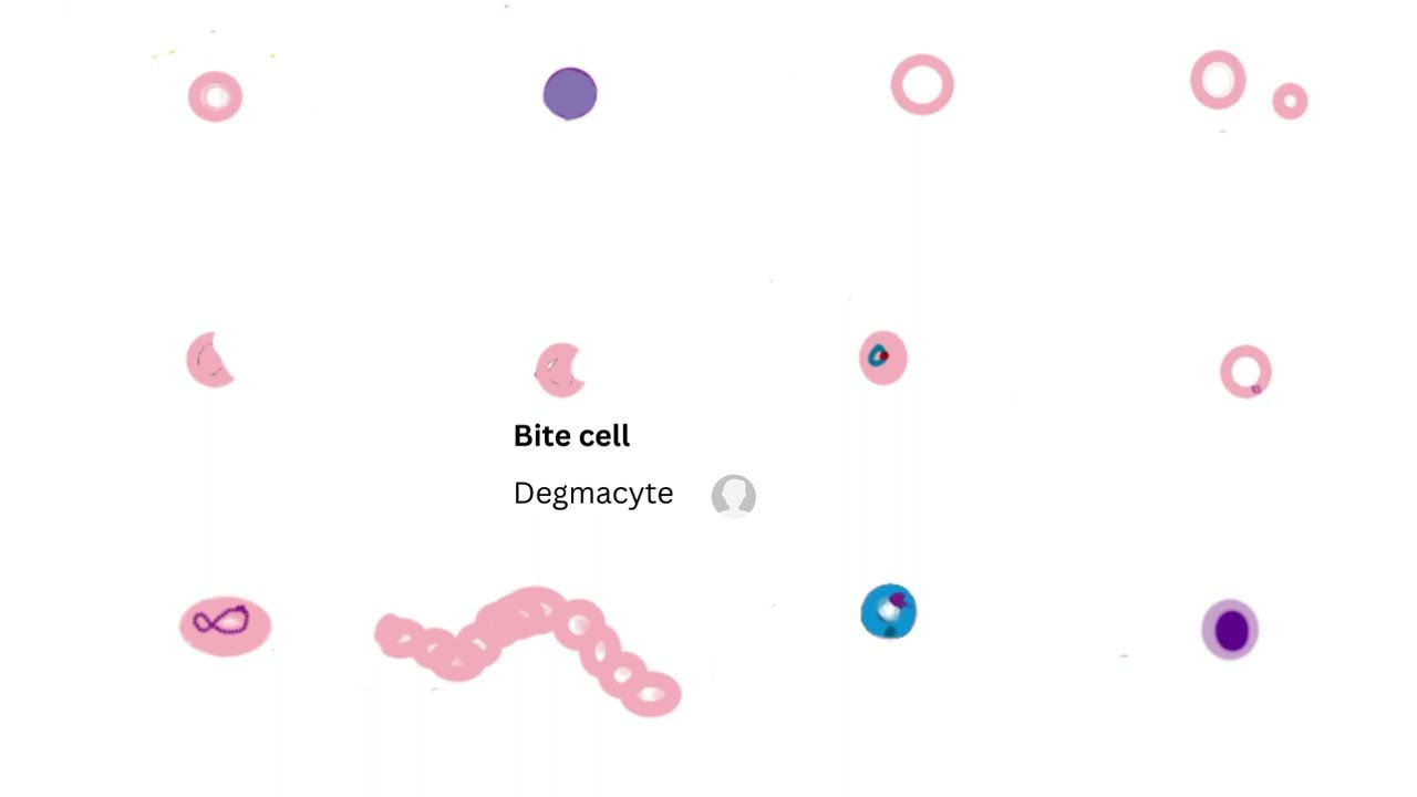 RBC Morphology for MLS (ASCP), CLS, MLT review for Board of Registry Exams.