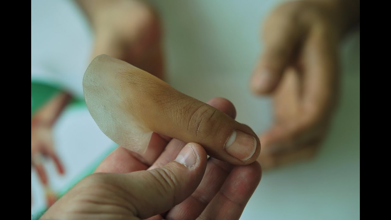 Protesis para dedo pulgar, (prosthetic thumb) No. 101