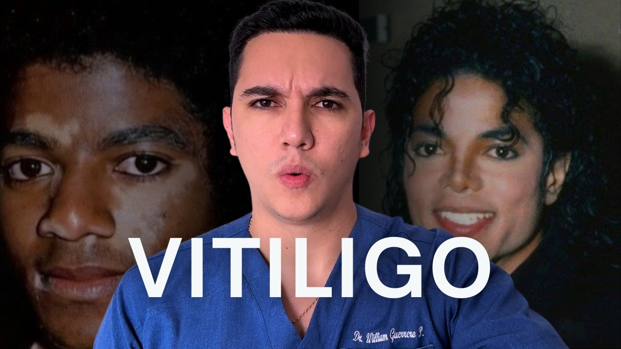 Vitiligo, la enfermedad que borra el color de tu piel | Dr. William Guerrero