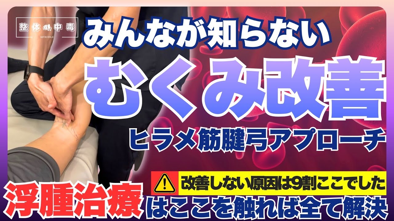 【浮腫(むくみ)を一撃でとる！】脚の浮腫(むくみ)施術で劇的変化を求める先生へ！浮腫(むくみ)の根本原因を理解し、ヒラメ筋腱弓の評価からアプローチまでを全て解説！#整体 #整体師 #整骨院 #むくみ