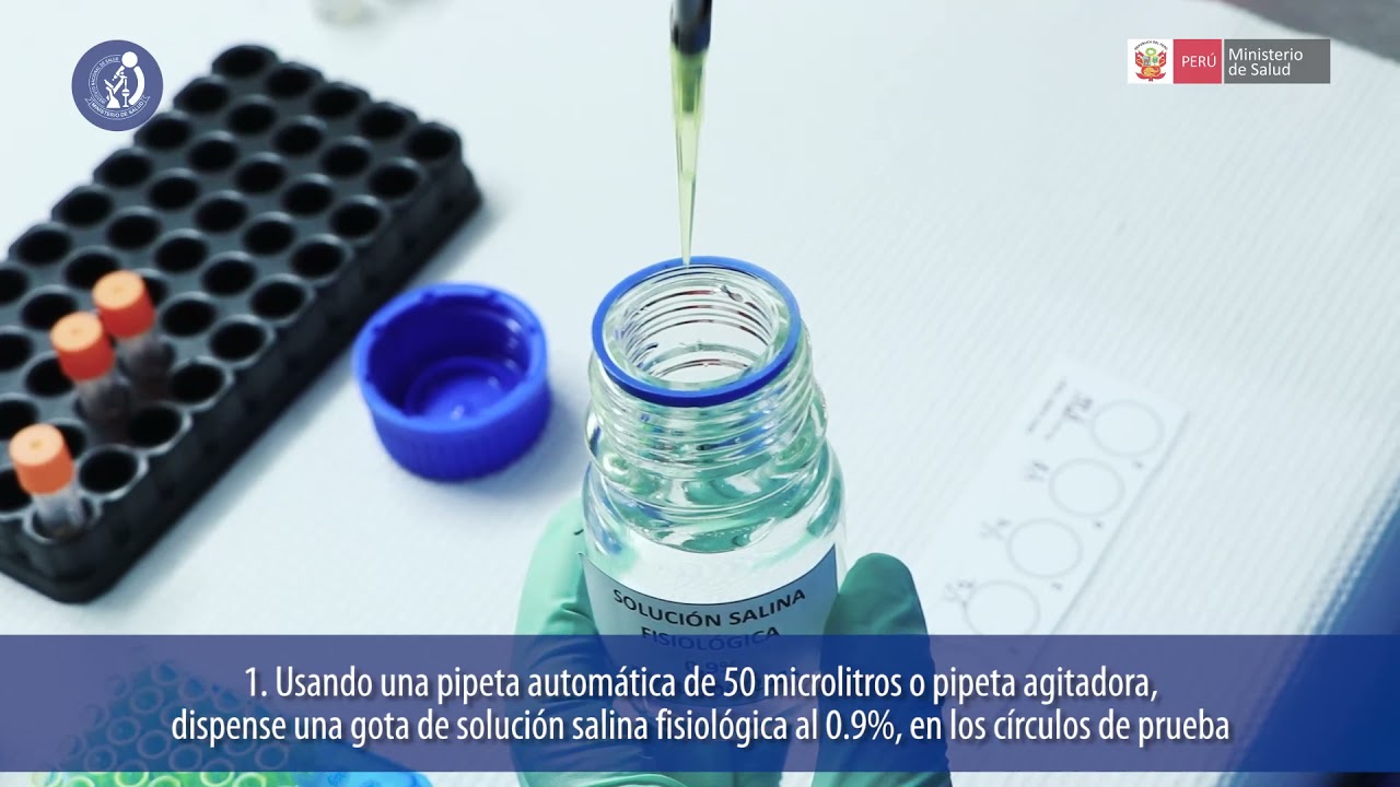 Desarrollo de la prueba Reagina Plásmatica Rápida (RPR) para el diagnóstico de Sífilis (Actualizado)