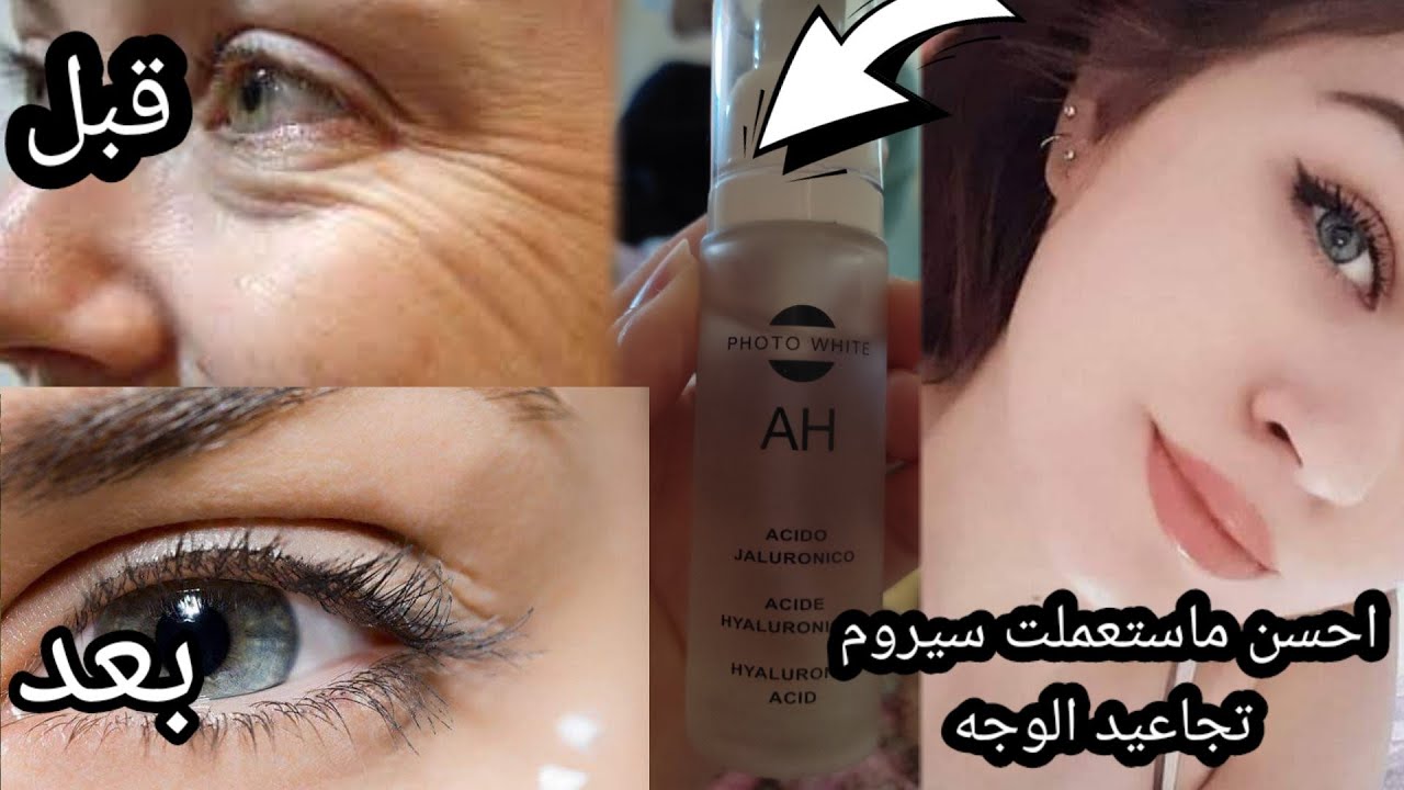 بغيتي تهناي من التجاعيد جبت ليك الحل هاد الكريم خطير  غادي يهنيك من كيف ما هناني
