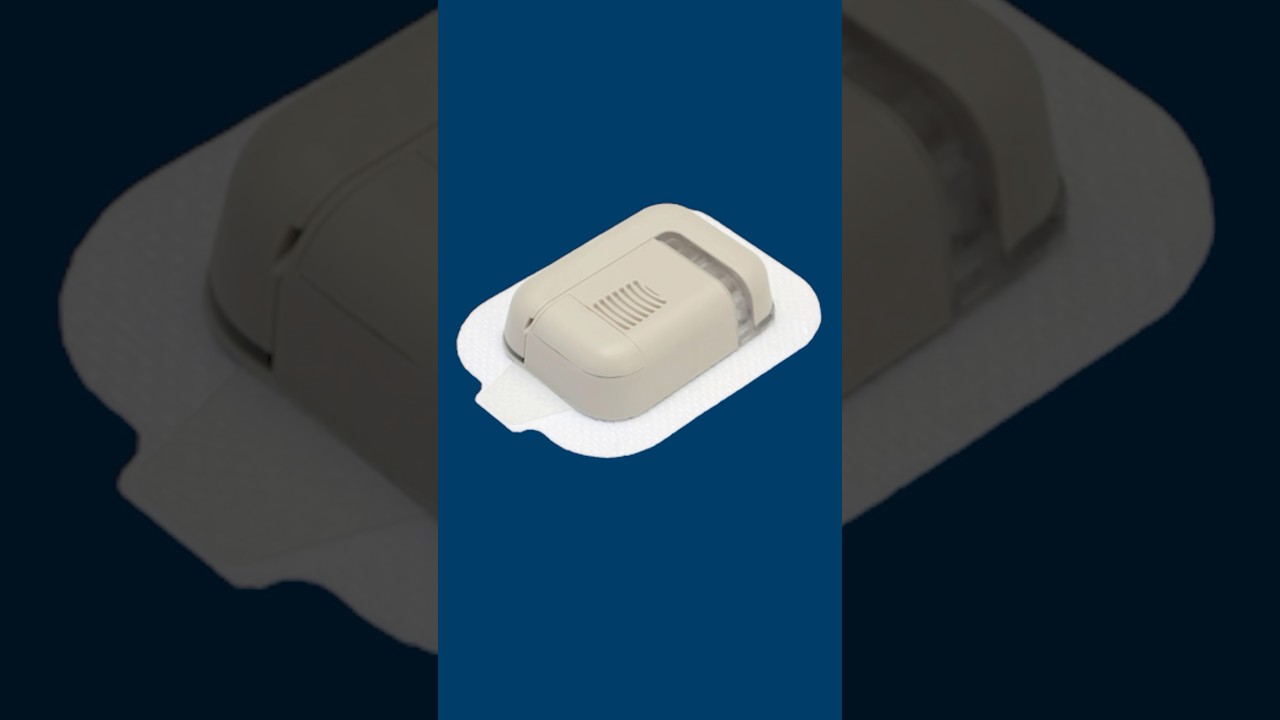New Tubeless Insulin Pump In Development #t1d #diabetes