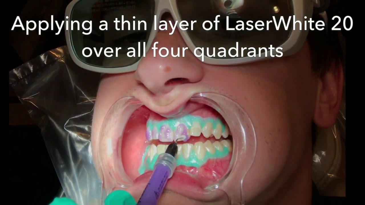 LaserWhite 20