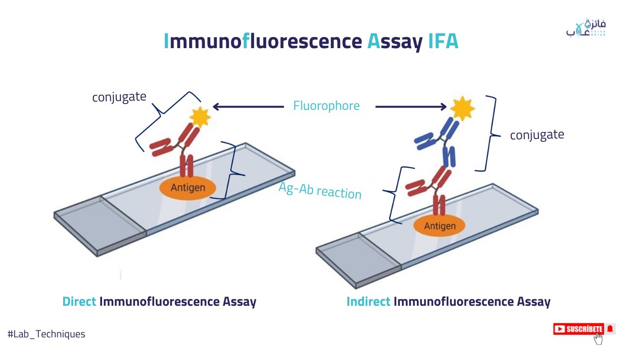 شرح مبدأ عمل تقنية Immunofluorescence Assay IFA