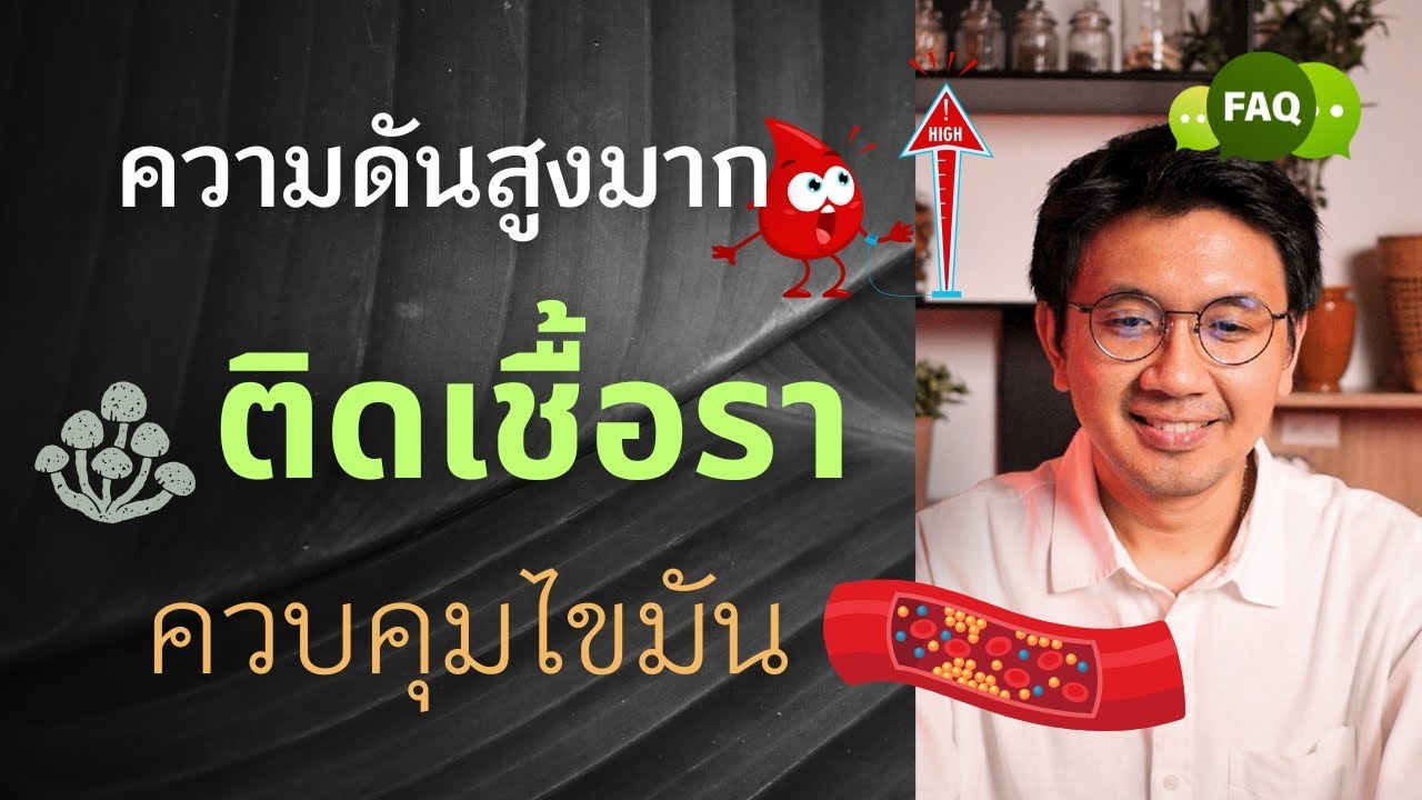 ทรงตัวไม่อยู่ | เสียดท้อง ปัสสาวะบ่อย | คอเลสเตอรอลสูง - หมอนัท ตอบคำถาม