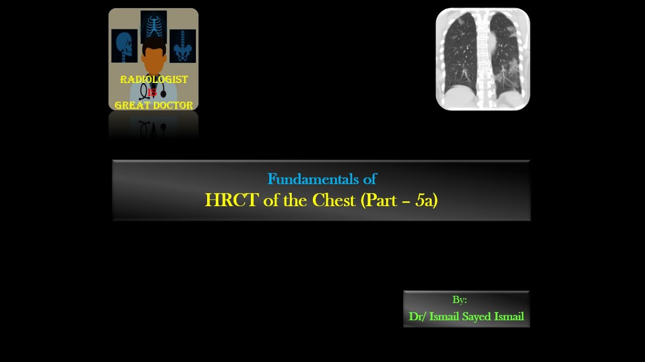 HRCT chest for Radiology Residents - Part 5a - Consolidation and GGO