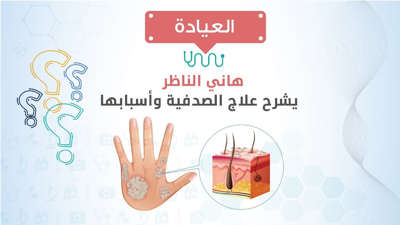 العيادة| هاني الناظر  يشرح علاج الصدفية وأسبابها