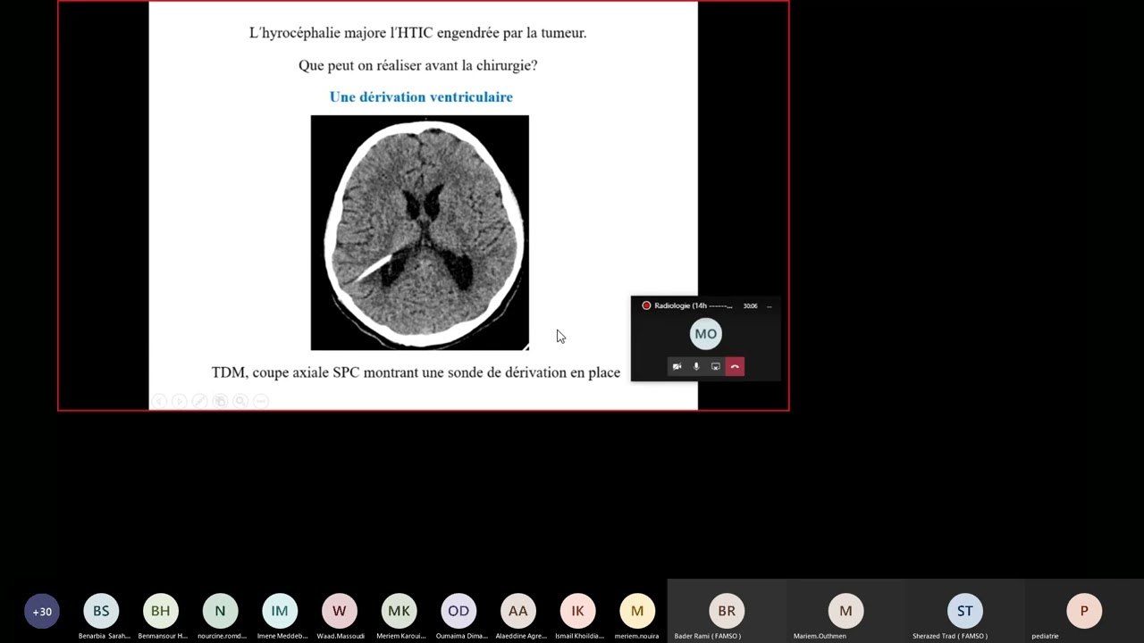 Visioconf - Pédiatrie : Imagerie neuro.