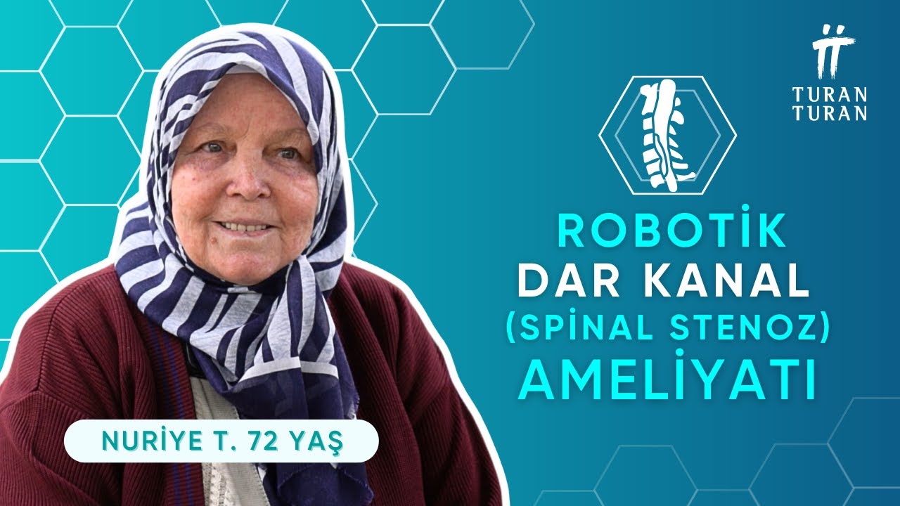 Dar Kanal Ameliyatı Olanların Yorumları: Robotik Omurga Cerrahisi ile Ağrılara Son (2023)