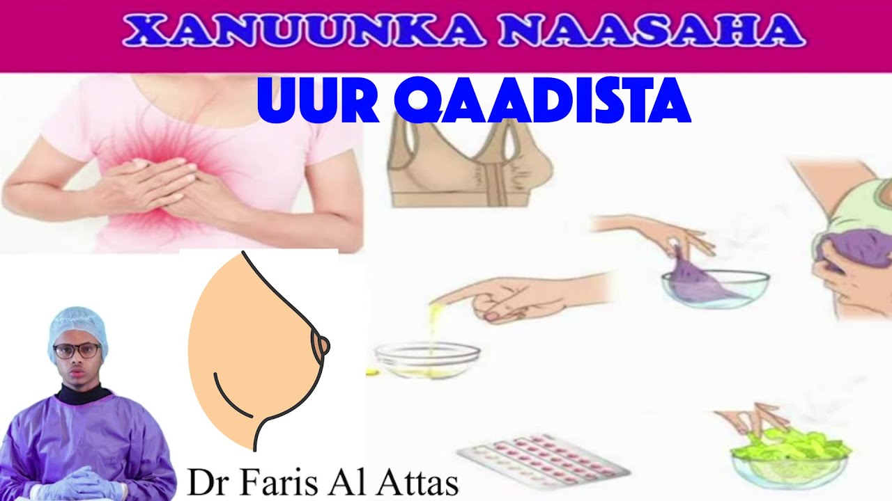 UUR QAADISTA IYO DANQASHADA NAASAHA. Drfaris
