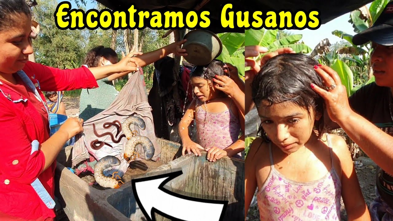 Al Bañar A Los Niños Encontramos Estos Gusanos En Su Ropa😲 Tenian Mucho Tiempo Sin Bañarse