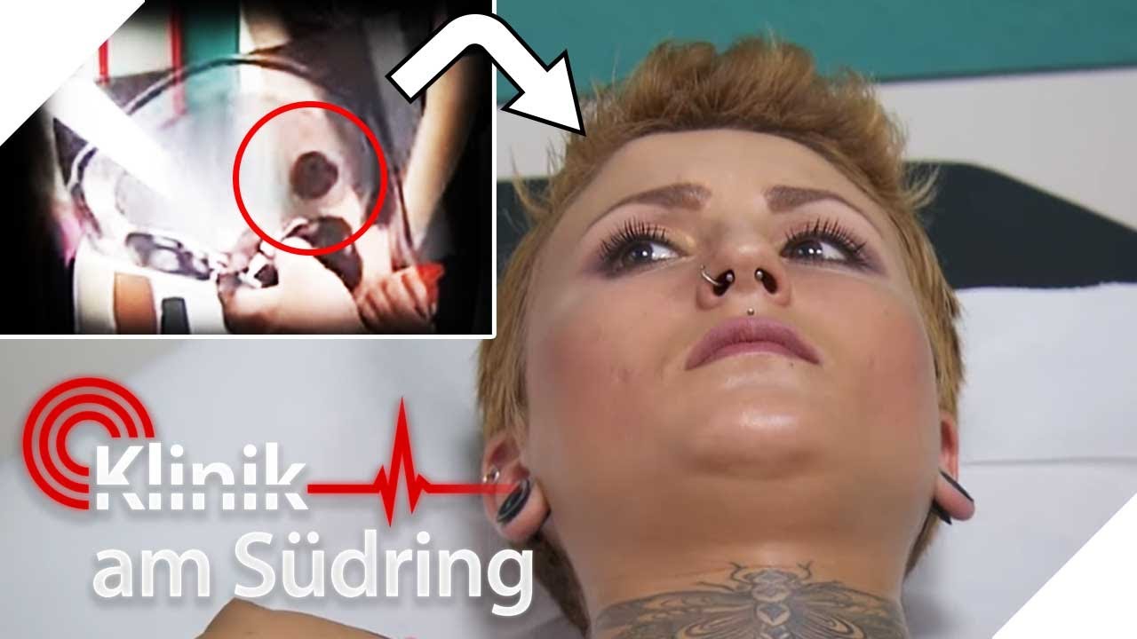 LUFT im GEHIRN 😨​💨​ &Auml;u&szlig;erst SELTENES Krankheitsbild ! | Klinik am S&uuml;dring | SAT.1