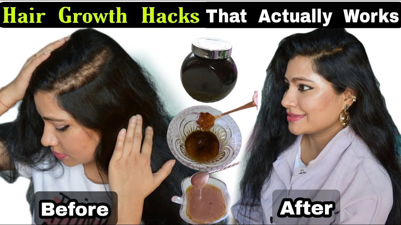 Hair Growth Hacks That Actually Works: These Hair Growth Hacks Helped Me To Regrow My Hair