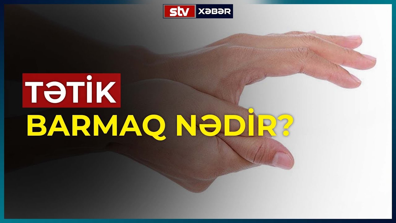 TƏTİK BARMAQ NƏDİR? - STV XƏBƏR