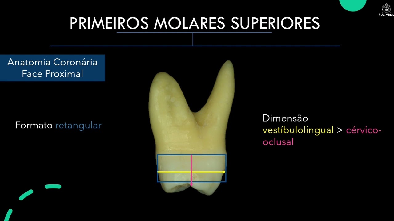 Gota #149 ANATOMIA DENTAL – Parte 7 – Primeiros e Segundos Molares Superiores