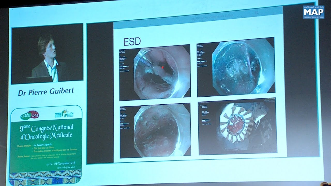 Congrès national de l'Oncologie médicale