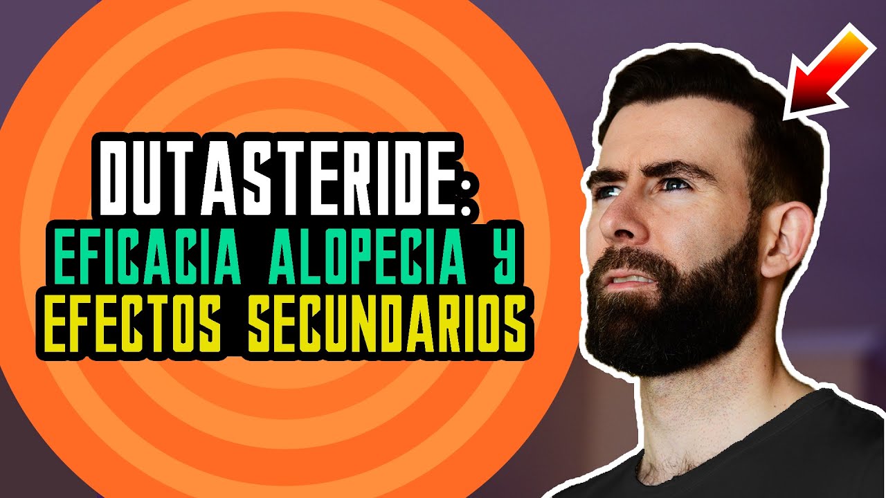 Dutasteride Para La Alopecia Androgenética