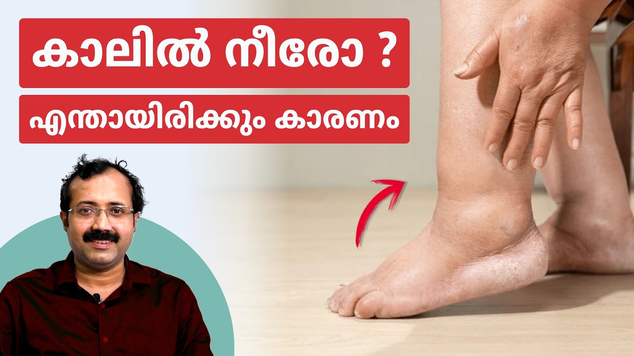 കാലിൽ നീരോ ? എന്തായിരിക്കും കാരണം | Dr. Padmanabha Shenoy | Rheumatologist