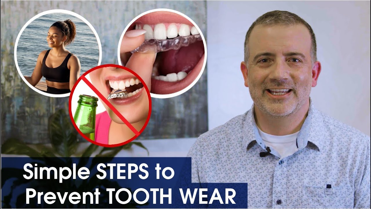 Tooth Wear 101 w/ Dr. O: What It Is + How to Prevent It | Austin Dental | Dentists in Austin, TX