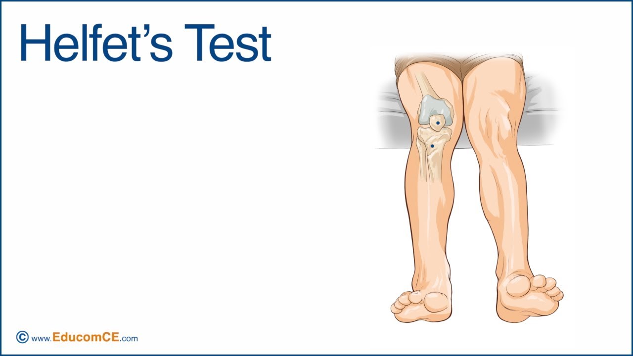Helfet's Test