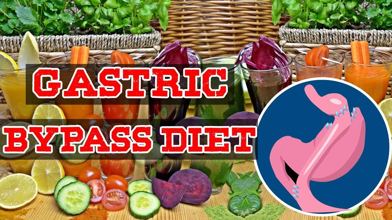 What foods to avoid after gastric bypass surgery? - Dr. Nanda Rajaneesh