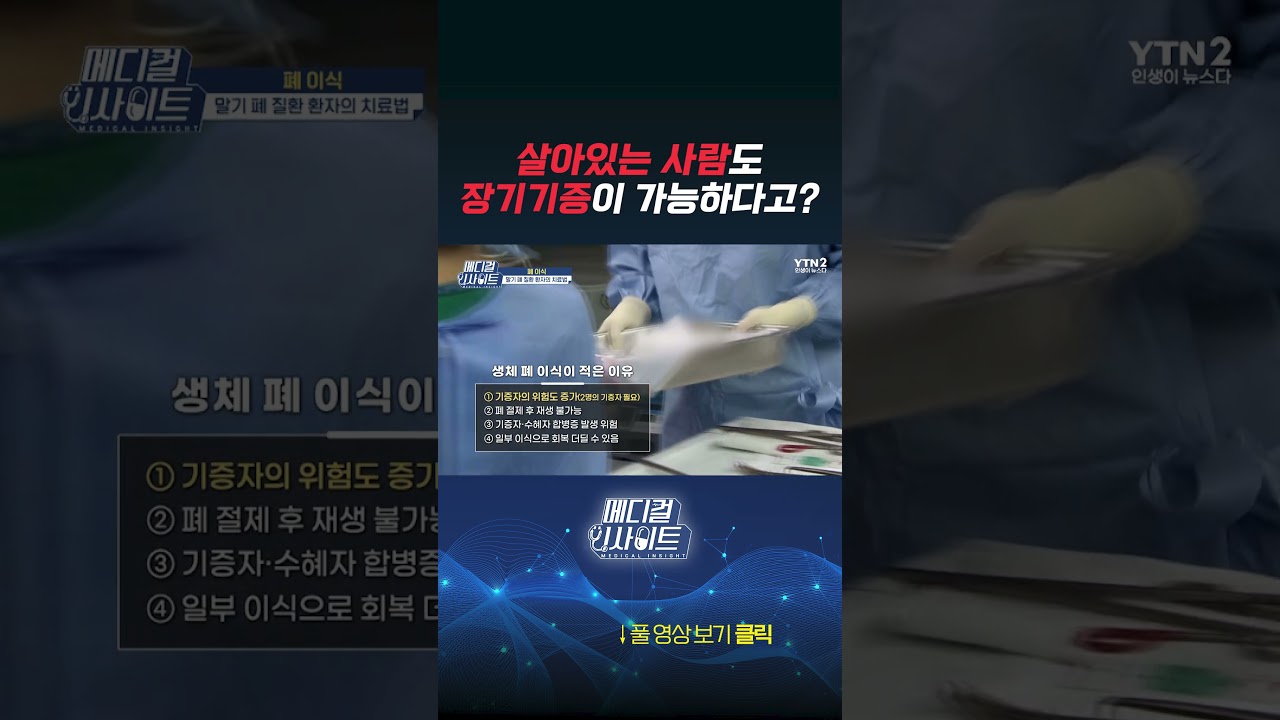 살아있는 사람도 장기기증이 가능하다고? #장기기증