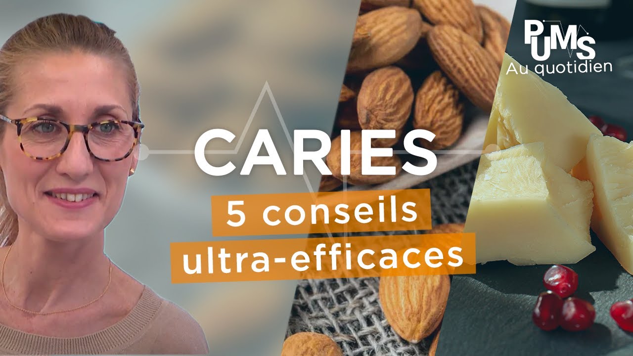 Carie dentaire : comment l'ÉVITER et la SOIGNER pour une meilleure santé ?
