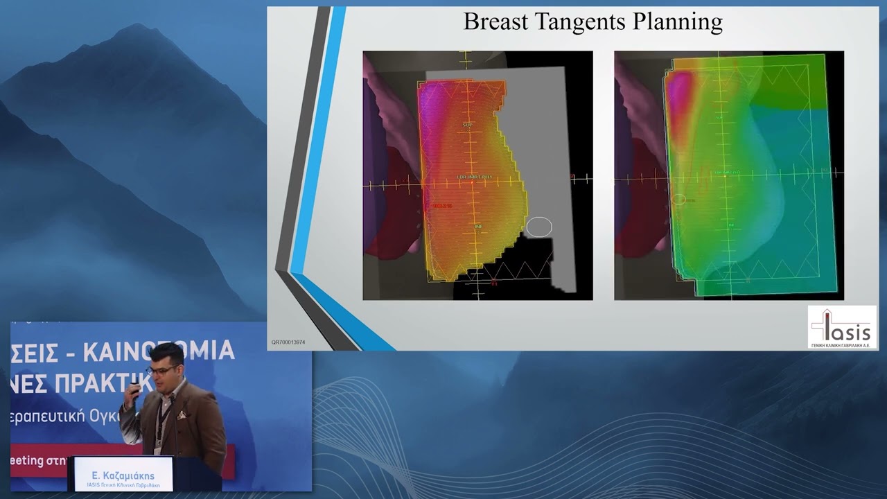 Truebeam treatment planning tips for breast cancer from a physicist's perspective-E.Kazamiakis