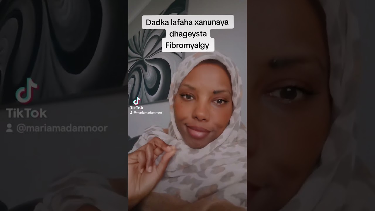lafa xanunka iyo fibromyalgy