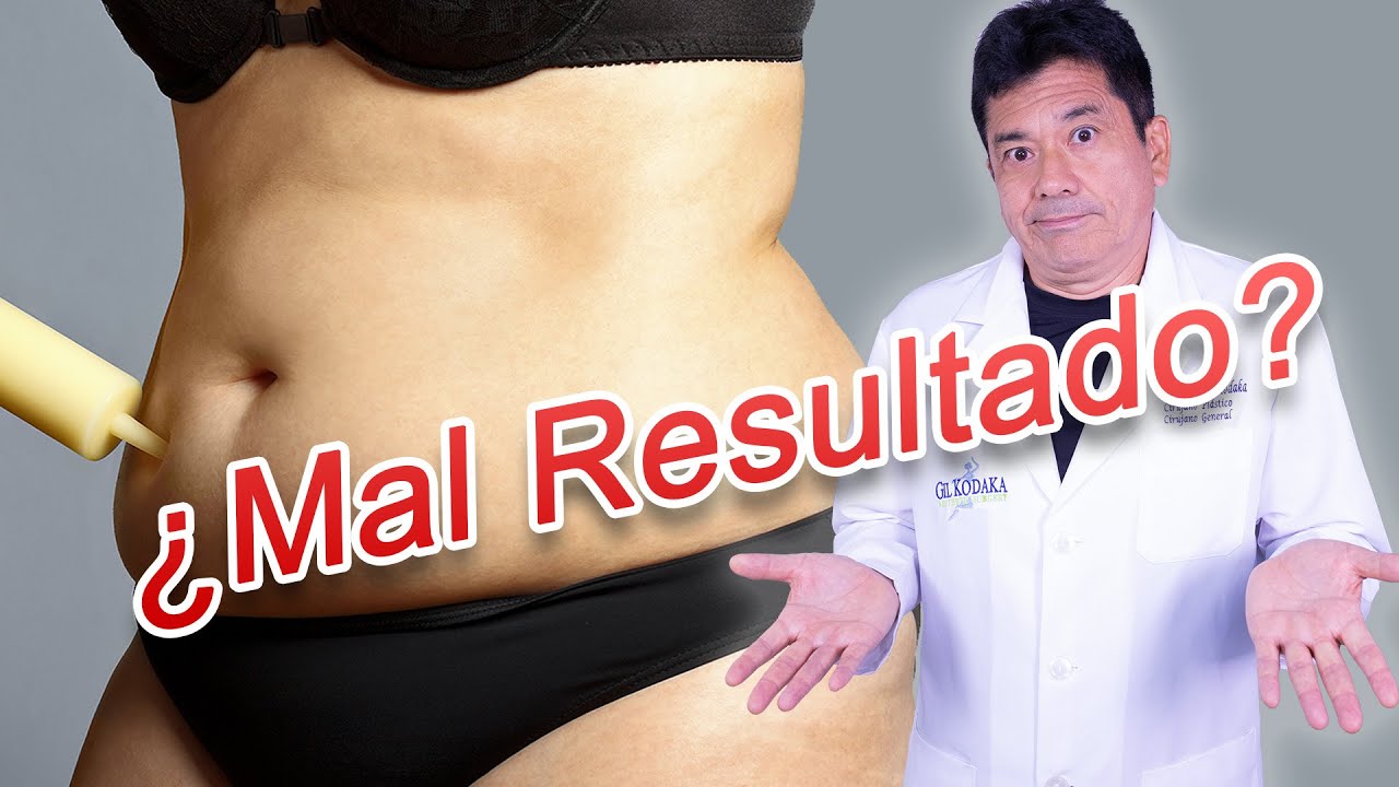 No Quede Conforme con mi Liposucción