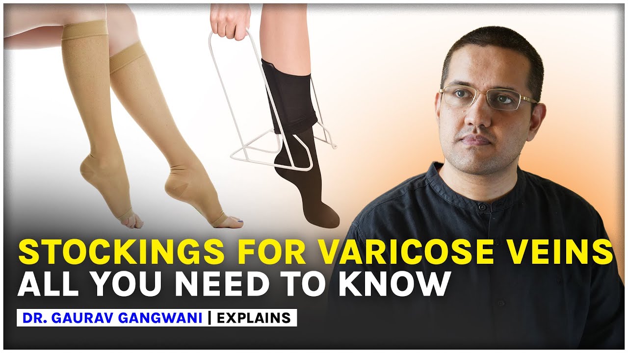Compression stockings for varicose veins | Varicose veins treatment | Dr. Gaurav Gangwani