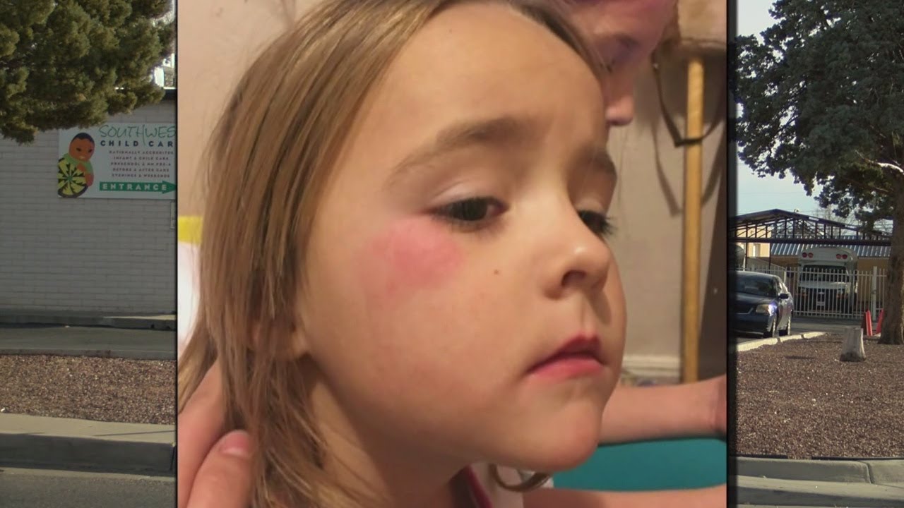 Albuquerque couple's daughter kicked out of preschool after being physically bullied