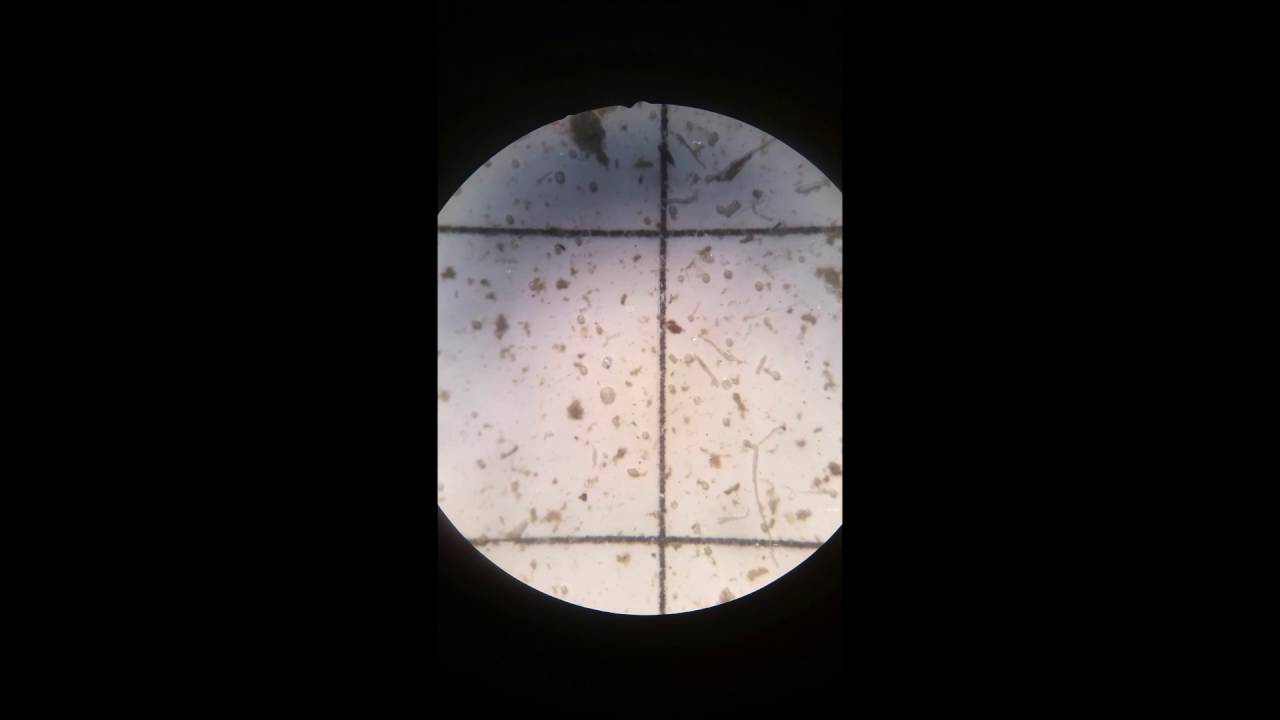 FMAP6 What are and aren't microplastics (diatoms vs microbeads)
